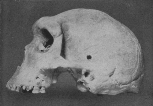 human skull side view. SIDE-VIEW OF A PREHISTORIC